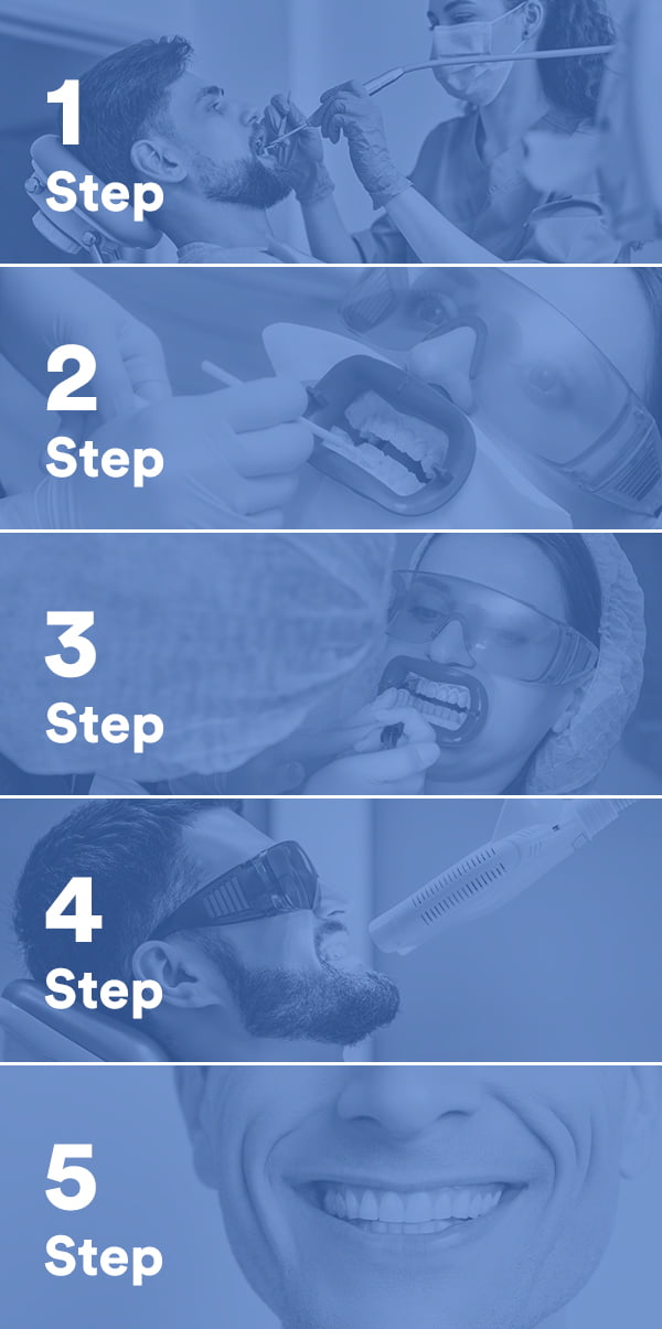 professional teeth whitening Markham, what to expect