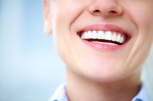 Teeth Whitening Markham professional dental clinic natural bright smile