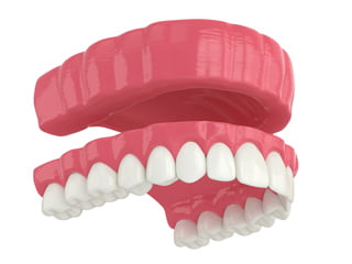 Traditional removable dentures are designed to replace a full arch of missing teeth and restore oral function.