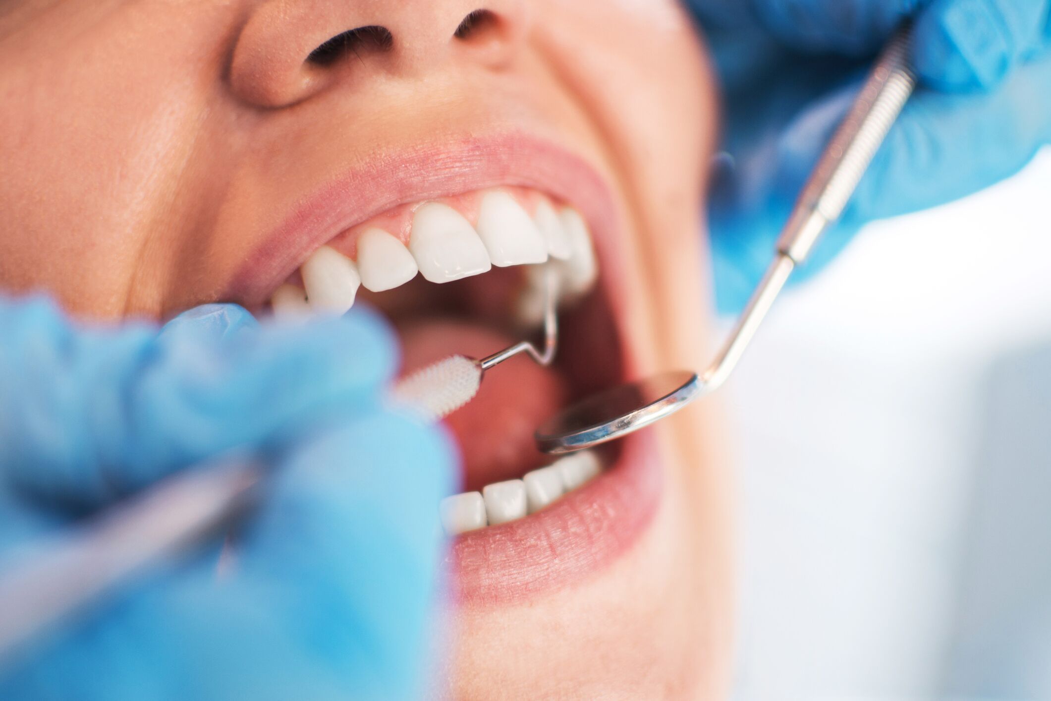 what-is-a-dental-check-up-procedure-markham-smile-centre