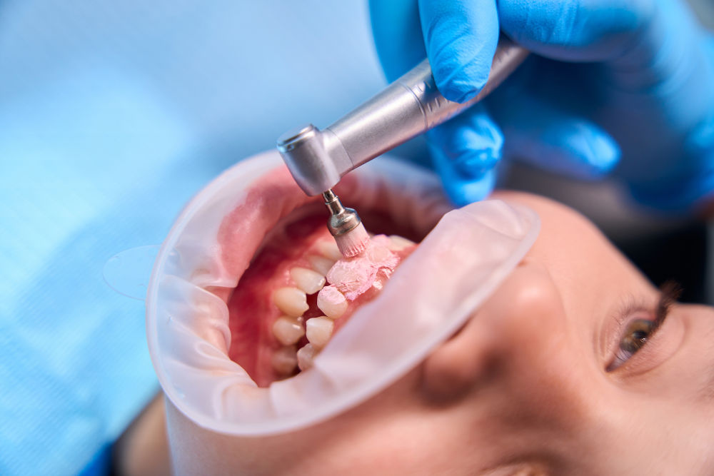 Patient smiling after professional teeth cleaning at Markham Smile Centre in Markham, Ontario